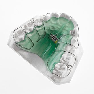 Model smile with pediatric orthodontic appliance