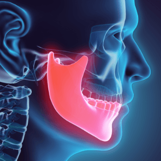 3 D x-ray of jaw and skull bone before dentofacial orthopedic treatment